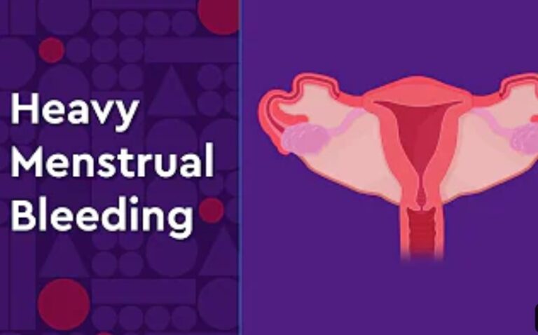 11 Causes of Heavy menstrual bleeding: What to do