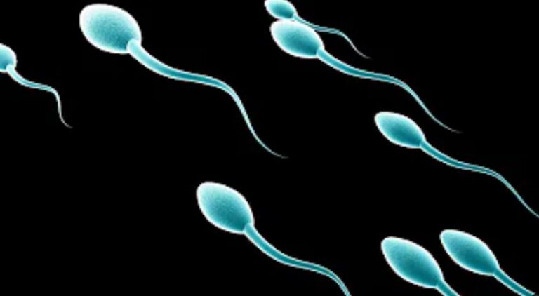12 Causes of Low Sperm Count, Treatment
