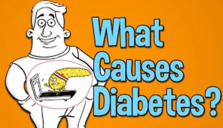 Diabetes: Causes, Symptoms, Treatment, Prevention.