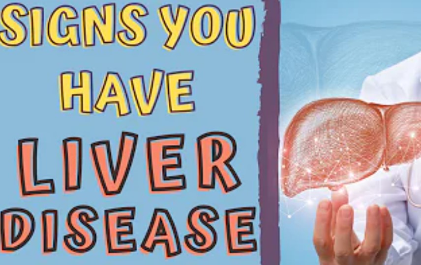 Having Yellow eyes, Stomach swelling? Liver Disease is a Possible cause!
