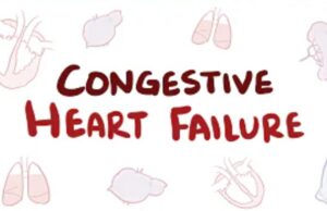 Heart Failure Causes, Symptoms, Treatment, Prevention