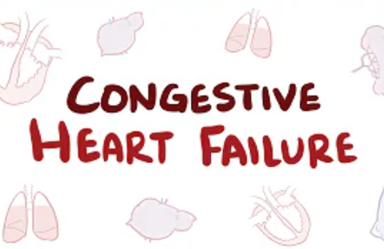 Heart Failure: Causes, Symptoms, Treatment, Prevention