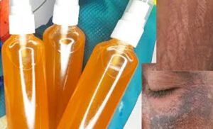 How to Make Bleached Skin Treatment Oil