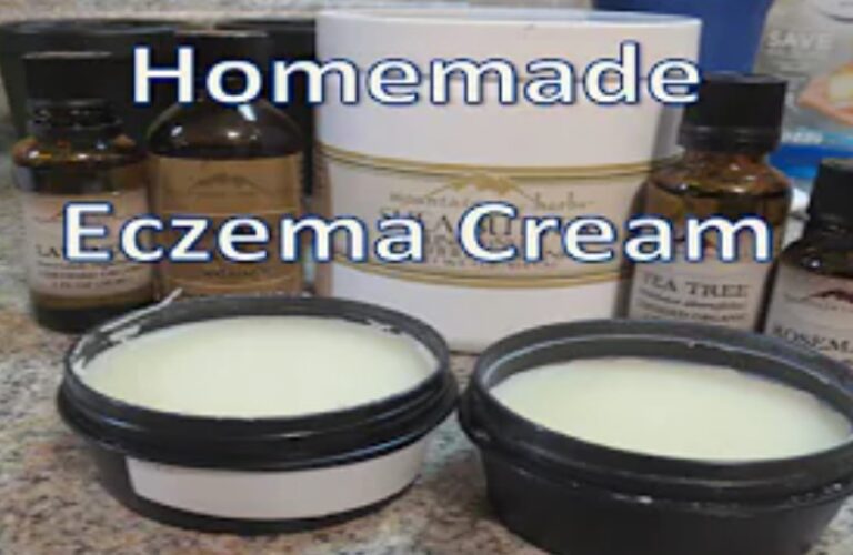 How to Make Eczema cream