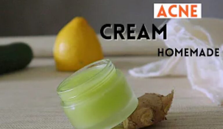 How to Make Pimples Face Cream