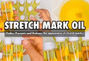 How to Make Stretch Mark Oil