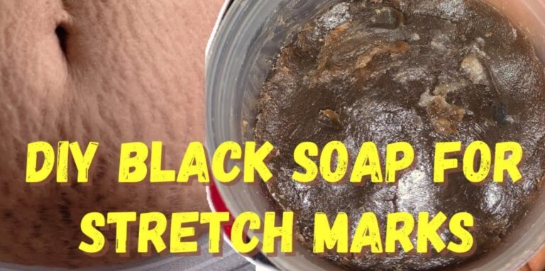 How to Make Stretch Marks Soap