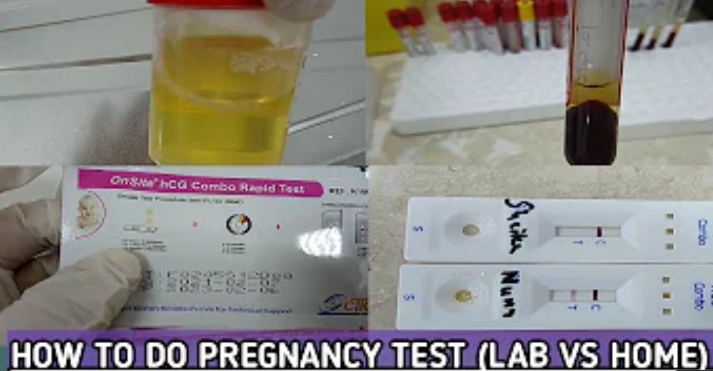 How to do Pregnancy Tests (Urine, Blood) and Costs