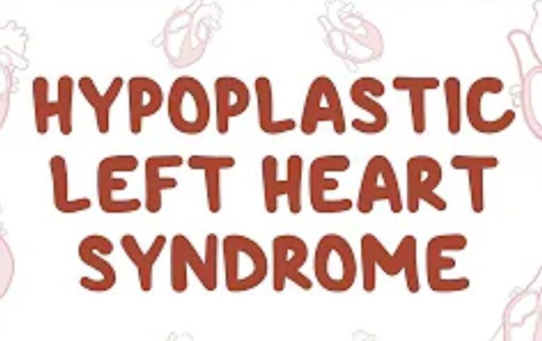 Hypoplastic Left Heart Syndrome: What it is and 3 Ways to Avoid It