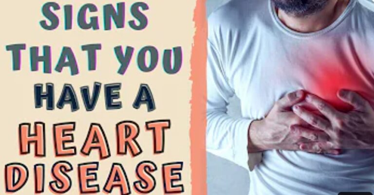 Symptoms of a Heart Attack: How to Know