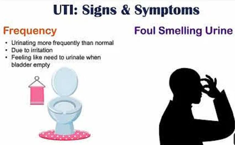 Urinary Tract Infection or  UTI: Causes, Symptoms, Treatment