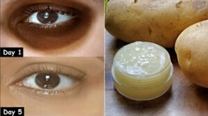 Skincare for Dark Under-Eye Circles